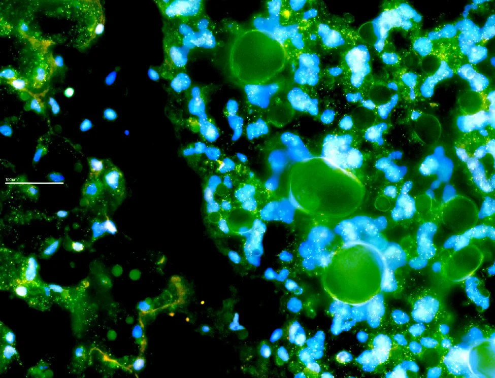 Merfish of brown fat.jpg