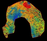 spatial metabolomics of white adipose tissue.jpg